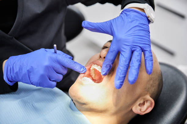 Best Emergency Gum Treatment in Selma, NC