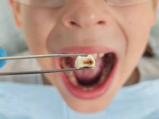 Best Emergency Gum Treatment in Selma, NC